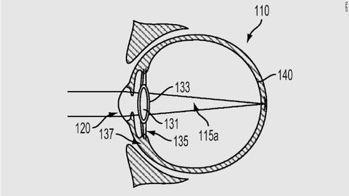 Google will sein nchstes Smart Device direkt im Auge unterbringen (Bild: Google)