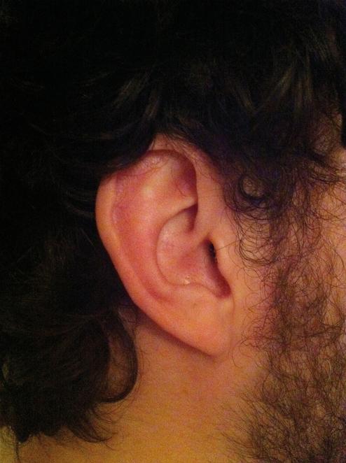 Im Tragus sitzt der implantierte Kopfhrer von Richard Lee (Bild: sarahyuro)