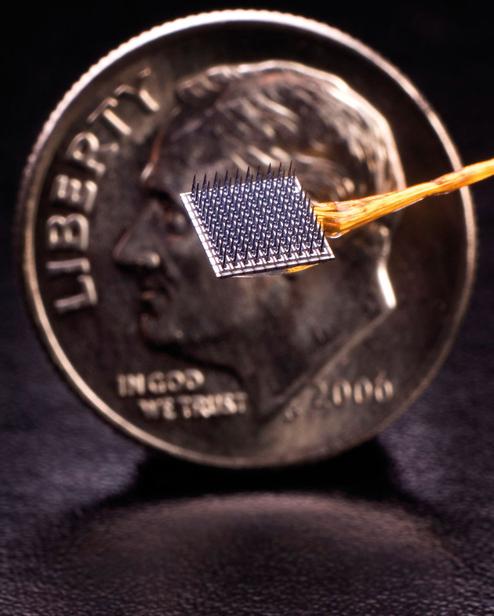 Das Braingate-Implantat in einer Grenstudie (Bild: Matthew McKee, BrainGate Collaboration)